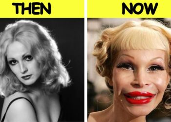 65 Disastrous Plastic Surgeries of Celebrities  Before and After THEN NOW