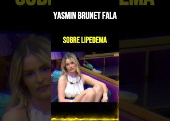 Yasmin Brunet Fala Sobre Lipedema