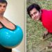18 CELEBRIDADES COM DEFORMIDADES CORPORAIS ESTRANHAS, ANTES E AGORA 2025!