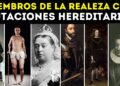 15 Miembros de la realeza con mutaciónes hereditarias