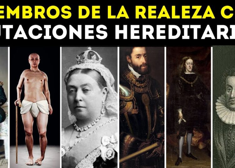 15 Miembros de la realeza con mutaciónes hereditarias