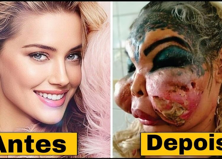 Celebridades Famosas Irreconhecíveis Após Cirurgias Plásticas Mal-Sucedidas | Antes e Depois 2025