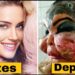 Celebridades Famosas Irreconhecíveis Após Cirurgias Plásticas Mal-Sucedidas | Antes e Depois 2025