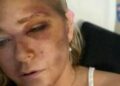 A vítima de Epstein, que alegou que o príncipe Andrew Abuse diz '4 dias para viver' em posto chocante | Real | Notícias