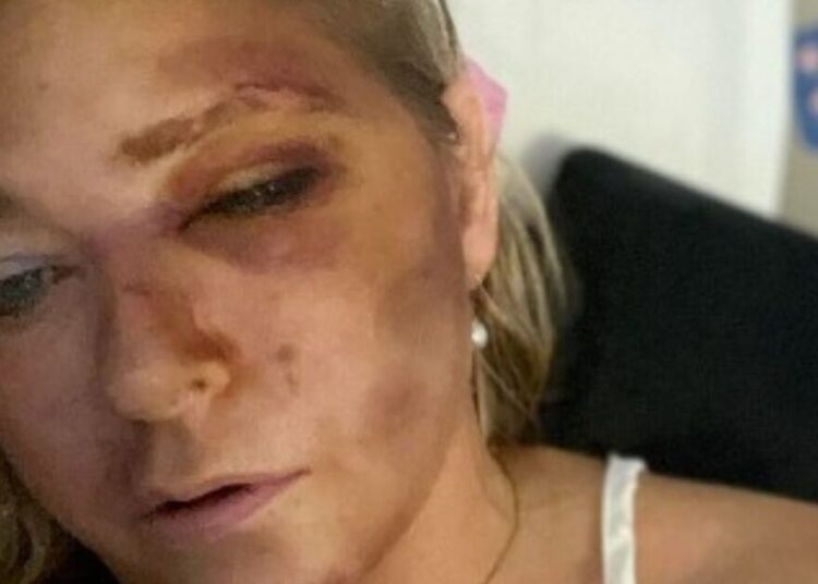A vítima de Epstein, que alegou que o príncipe Andrew Abuse diz '4 dias para viver' em posto chocante | Real | Notícias