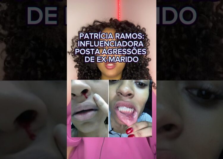 INFLUENCIADORA POSTA AGRESSÕES DE EX-MARIDO🥺 #shorts #entretenimentos #curiosidades #fofocas