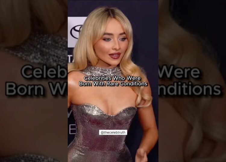 Celeb Secrets: Rare Birth Conditions! 🤫 #hollywood #celebs #shorts