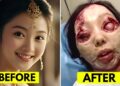 Chinese Celebrities and the Cost of Cosmetic Perfection