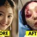 Chinese Celebrities and the Cost of Cosmetic Perfection