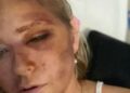 Atualização de saúde de Virginia Giuffre como o acusador sexual do príncipe Andrew atinge o Back | Real | Notícias