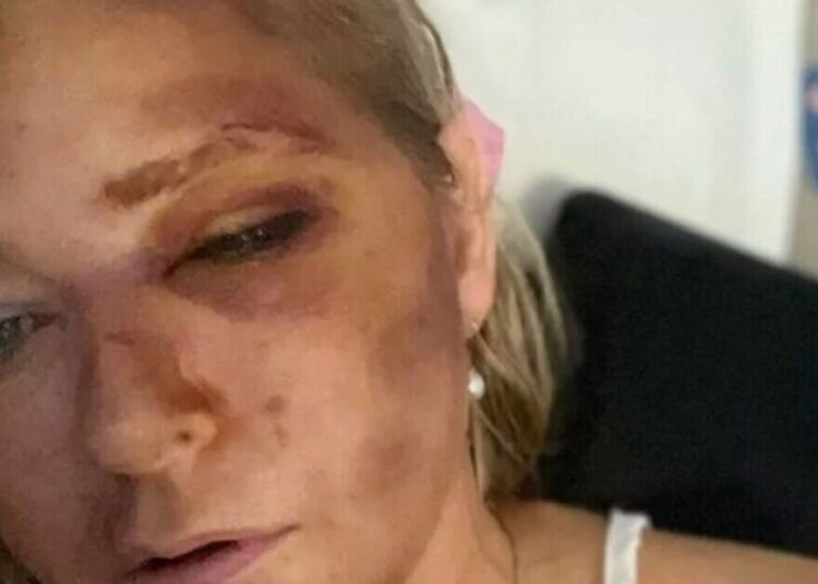Atualização de saúde de Virginia Giuffre como o acusador sexual do príncipe Andrew atinge o Back | Real | Notícias