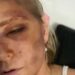 Atualização de saúde de Virginia Giuffre como o acusador sexual do príncipe Andrew atinge o Back | Real | Notícias