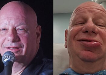 O comediante Jeff Ross hospitalizado por reação alérgica depois de tomar sorvete