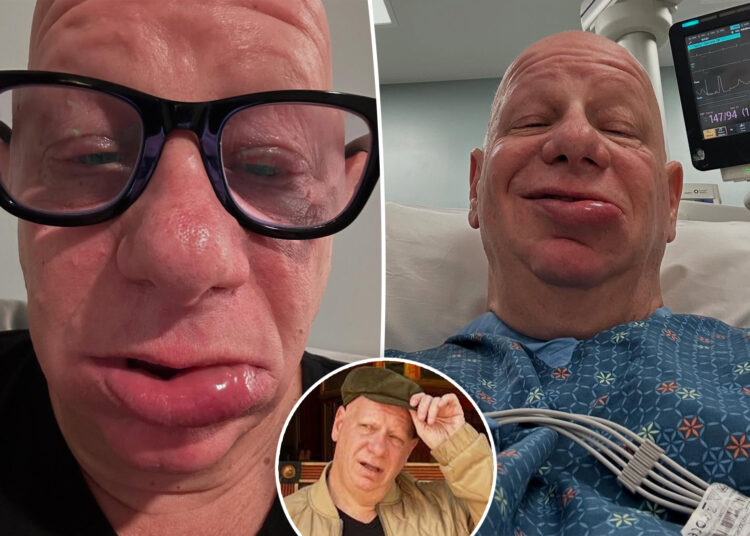 O comediante Jeff Ross passou a noite no er 'com reação alérgica ao sorvete