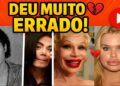 19 CIRURGIAS PLÁSTICAS DE FAMOSOS QUE DERAM MUITO ERRADO