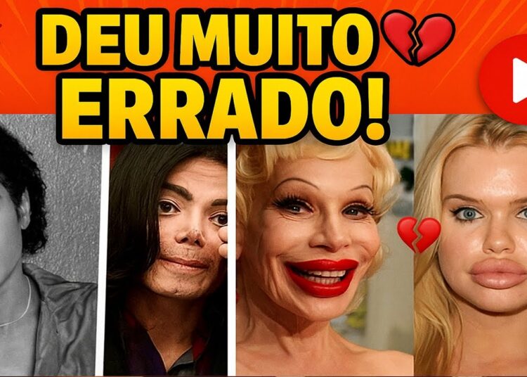 19 CIRURGIAS PLÁSTICAS DE FAMOSOS QUE DERAM MUITO ERRADO