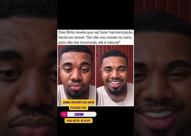 Davi Brito diz que vai fazer harmonização #famosos #fofoca #fofocadodia #fofocadefamosos #fofocas