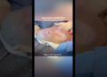 Notícias viral : Bebê nasce empelicada e encanta equipe médica #noticias #fofocas #viralizou #trend