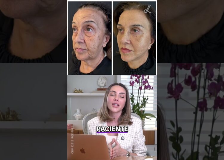 Rosto Natural Técnica Secreta das Celebridades também no Brasil!