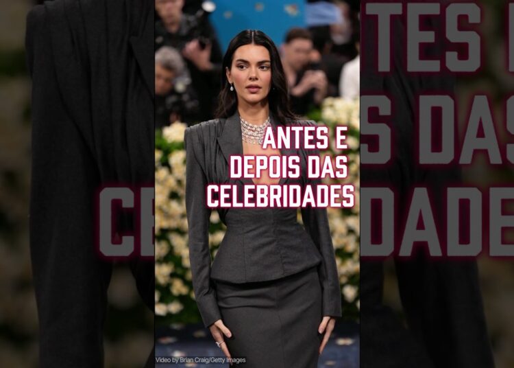 Você Reconhece Essas Famosas Antes e Depois?