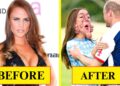 30 Plastic Surgery Disasters That Made Hollywood Stars Lose Everything! | Hollywood Discovery