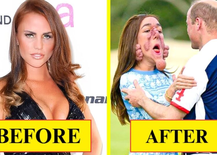 30 Plastic Surgery Disasters That Made Hollywood Stars Lose Everything! | Hollywood Discovery