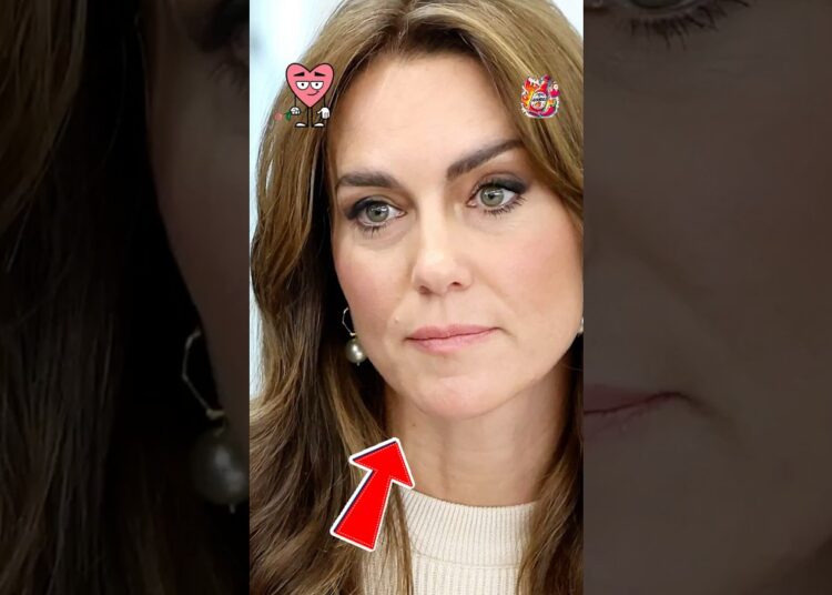 ¡KATE MIDDLETON INGRESA EN EL HOSPITAL! “PREOCUPANTE ESTADO DE SALUD”