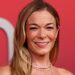 Os dentes de Leann Rimes caíram no meio da música no concerto recente