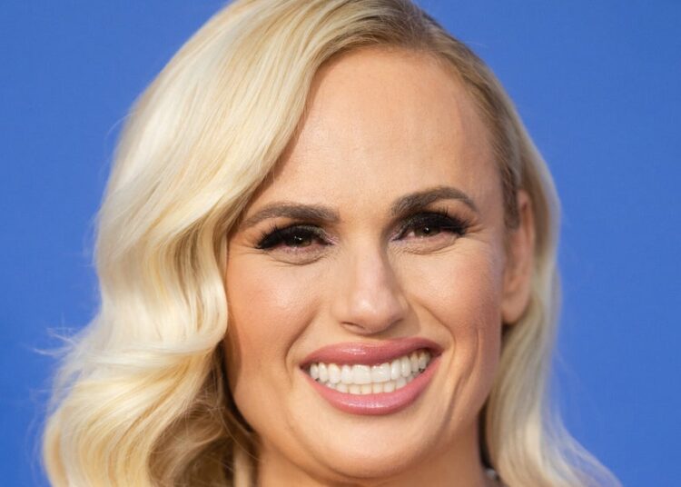 Rebel Wilson escapa por pouco de desfiguração após acidente no set