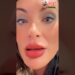 Andressa Urach atualiza: Visão Embasada e Muita Dor