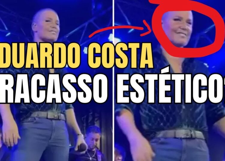 EDUARDO COSTA VIROU A XUXA A HARMONIZAÇÃO FACIAL MAIS BIZARRA DO BRASIL!