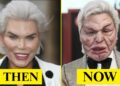 10 Plastic Surgery Disasters That Became Hollywood Cautionary Tales |Then and Now 2025
