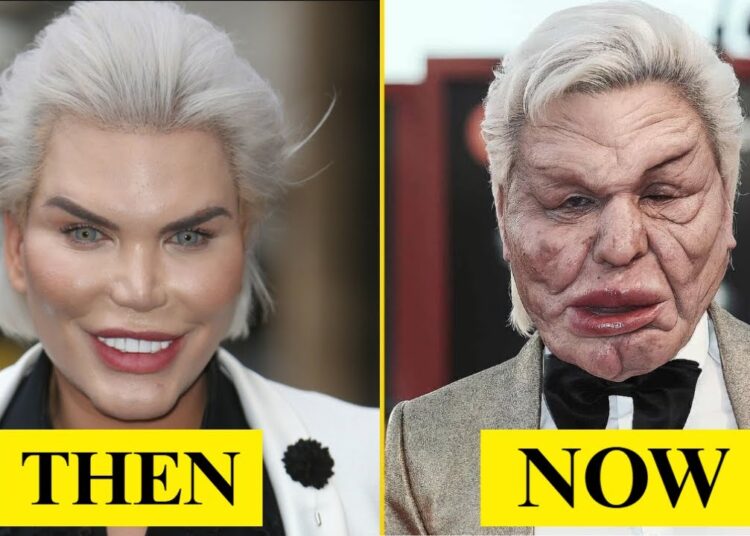 10 Plastic Surgery Disasters That Became Hollywood Cautionary Tales |Then and Now 2025