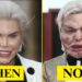 10 Plastic Surgery Disasters That Became Hollywood Cautionary Tales |Then and Now 2025