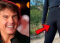 20 Celebridades Com Deformidades Corporais Estranhas