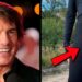 20 Celebridades Com Deformidades Corporais Estranhas