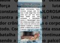A DOR Secreta de Lady Gaga! Luta Diária!