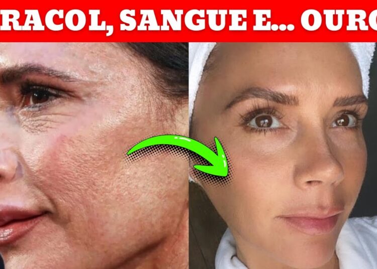 Você Não Vai Acreditar no Que Essas Estrelas Famosas Usam na Pele! 🌟
