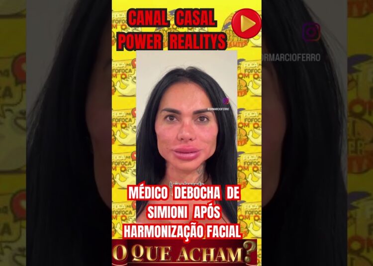 MÉDICO DEBOCHA DE SIMIONI APÓS HARMONIZAÇÃO FACIAL #simioni #fofocas #casalpowerrealitys