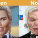 You Won’t Believe How These Stars Transformed Due to Plastic Surgery!