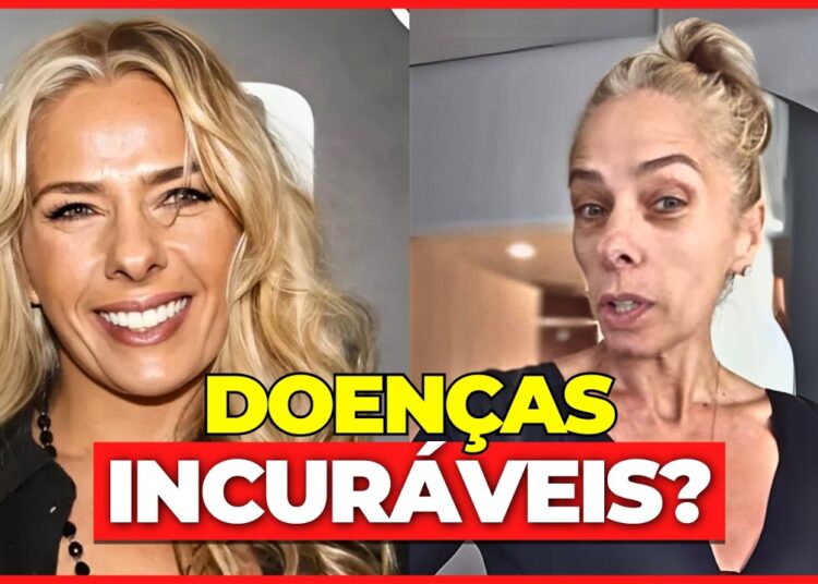 13 FAMOSOS QUE ESTÃO MUITO DOENTES E VOCÊ NEM IMAGINAVA… 😢