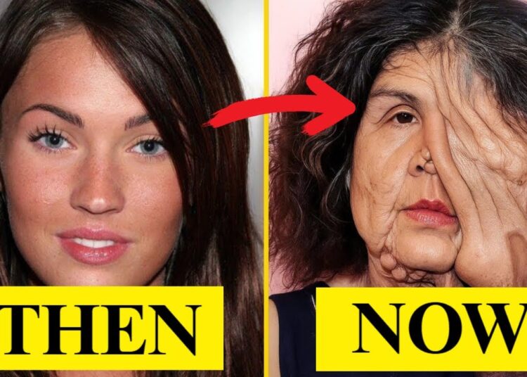 15 Disastrous Plastic Surgeries of Celebrities THEN and NOW | Then and Now 2025