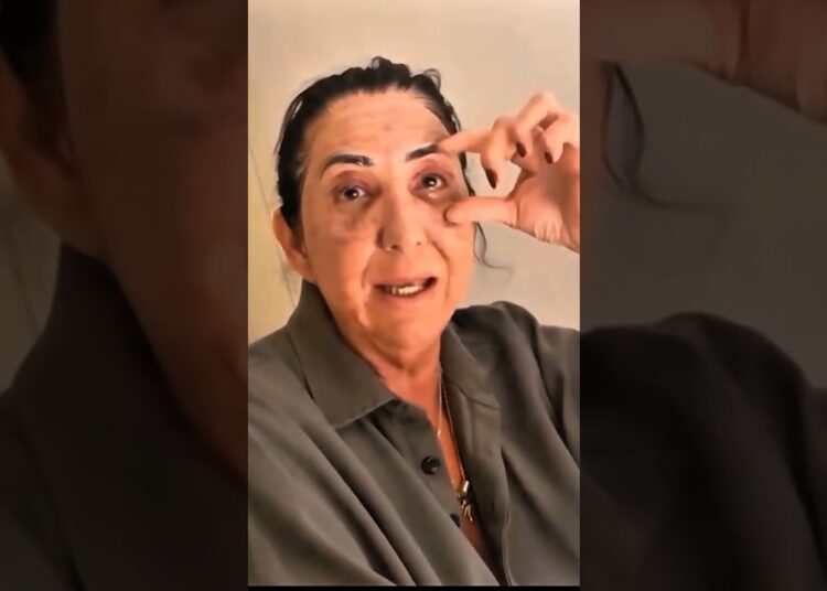 MARGARETH FEZ O PROCEDIMENTO E PERDEU O BOY! #fofoca #celebridades #famosos