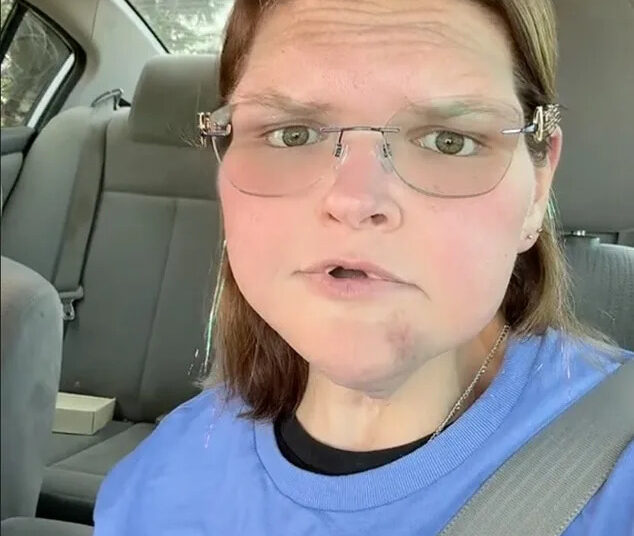 1000 lb. Sister S 'Tammy Slaton responde à preocupação com a hematomas faciais