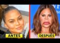 10 desastres de cirurgia plástica de celebridades
