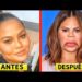 10 desastres de cirurgia plástica de celebridades