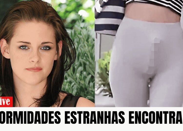 20 Atores Com Deformidades Corporais Incríveis e Surpreendentes!
