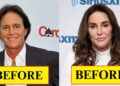 15 Transgender Celebrities That Hollywood Tried to Hide | Then and Now 2025