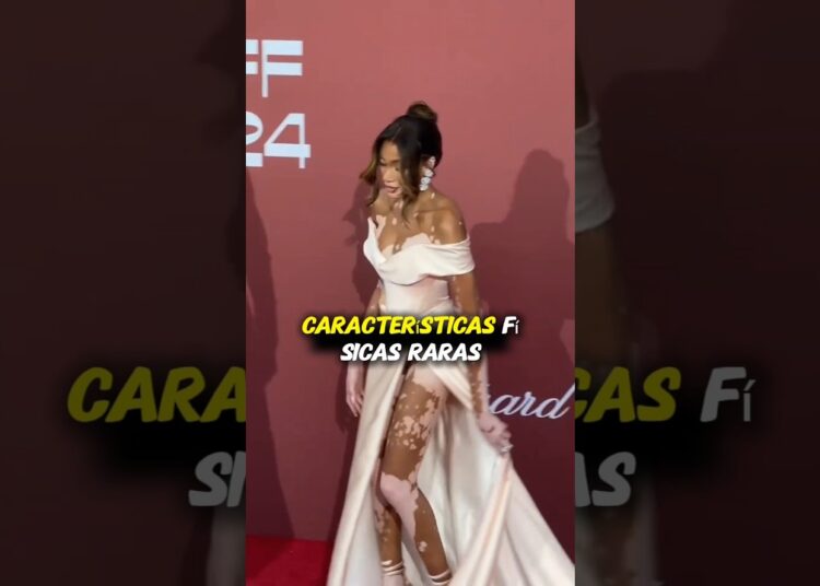 4 celebridades com características físicas raras. #hollywood #celebridades #noticiasviral