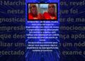 VAL MARCHIORI REVELA ESTAR COM CANCER DE MAMA